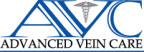 varicose vein treatments